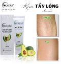 Kem Tẩy Lông FACEPLUS Bơ