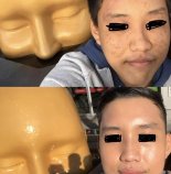 Từ da đầy mụn thành căng mọng mướt mát: bên cạnh chu trình dưỡng, anh chàng này còn phải từ bỏ một t