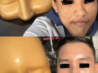 Từ da đầy mụn thành căng mọng mướt mát: bên cạnh chu trình dưỡng, anh chàng này còn phải từ bỏ một t